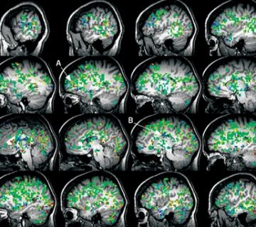 Ovo je tvoj mozak za vreme orgazma 360x320